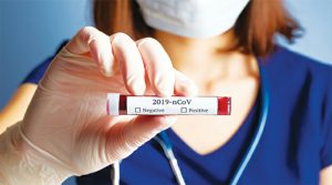 Coronavirus-Berasal-dari-Virus-Hewan-dan-Berbeda-dengan-SARS-1_800x445